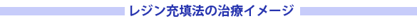 レジン充填法の治療イメージ