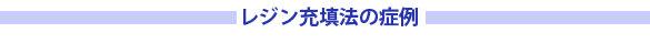 レジン充填法の症例