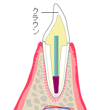 補綴治療