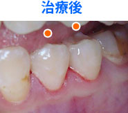 治療後